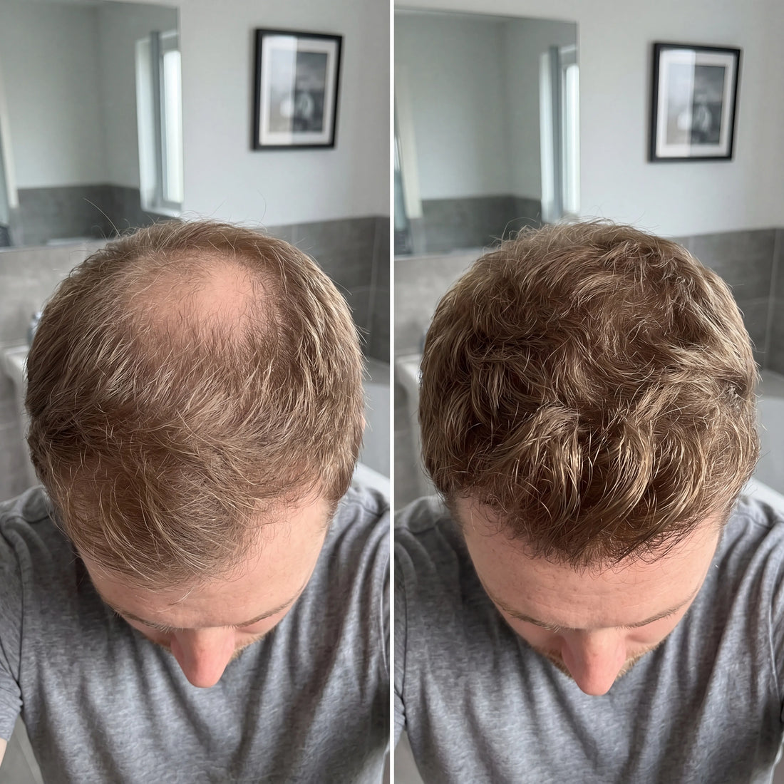 Korean Scalp Ritual Bar