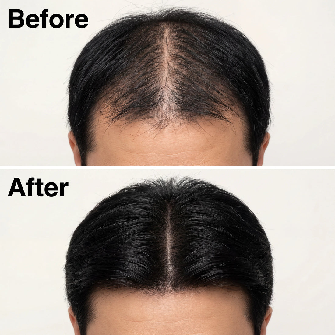 Korean Scalp Ritual Bar