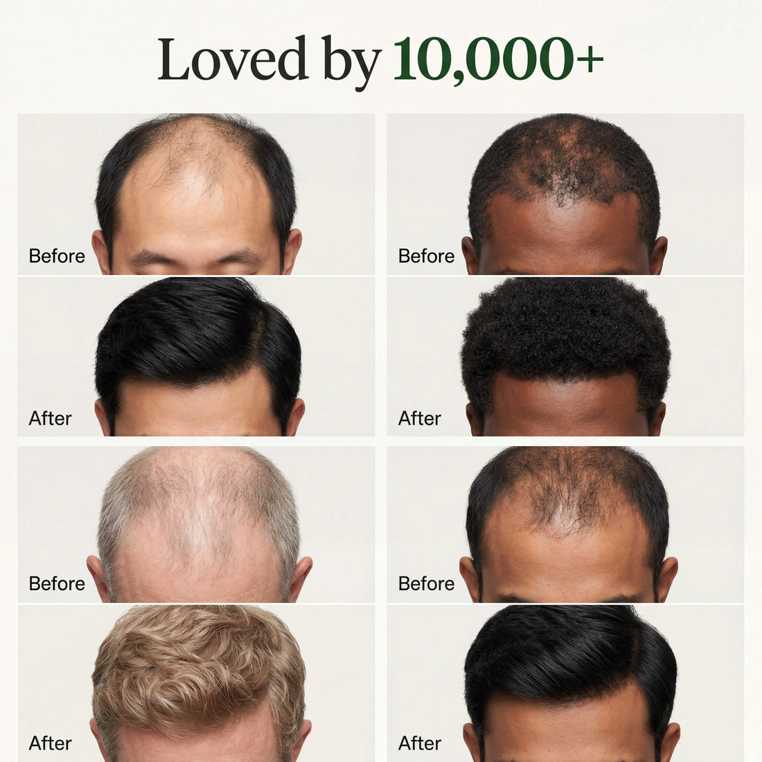 Korean Scalp Ritual Bar