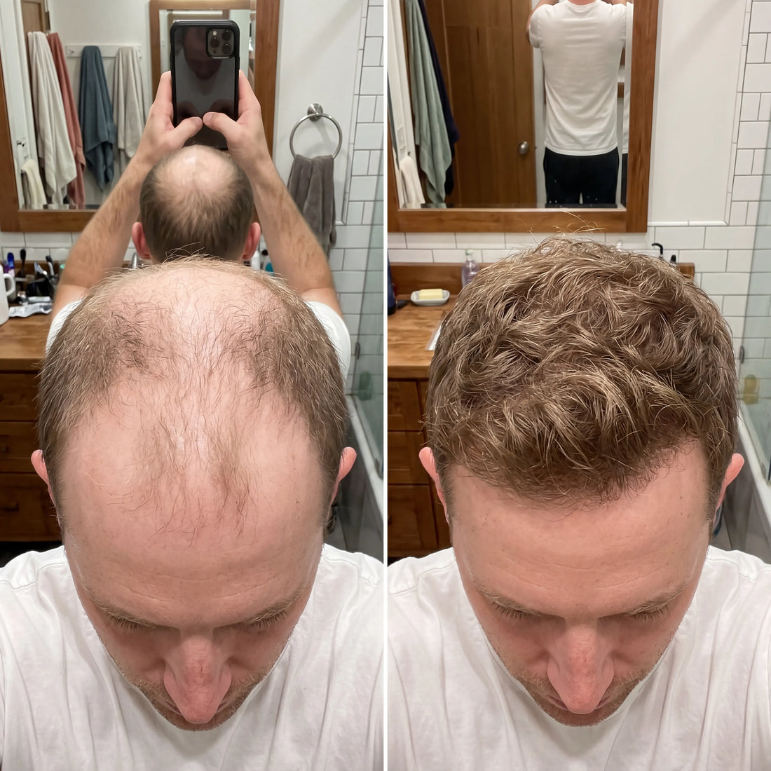 Korean Scalp Ritual Bar