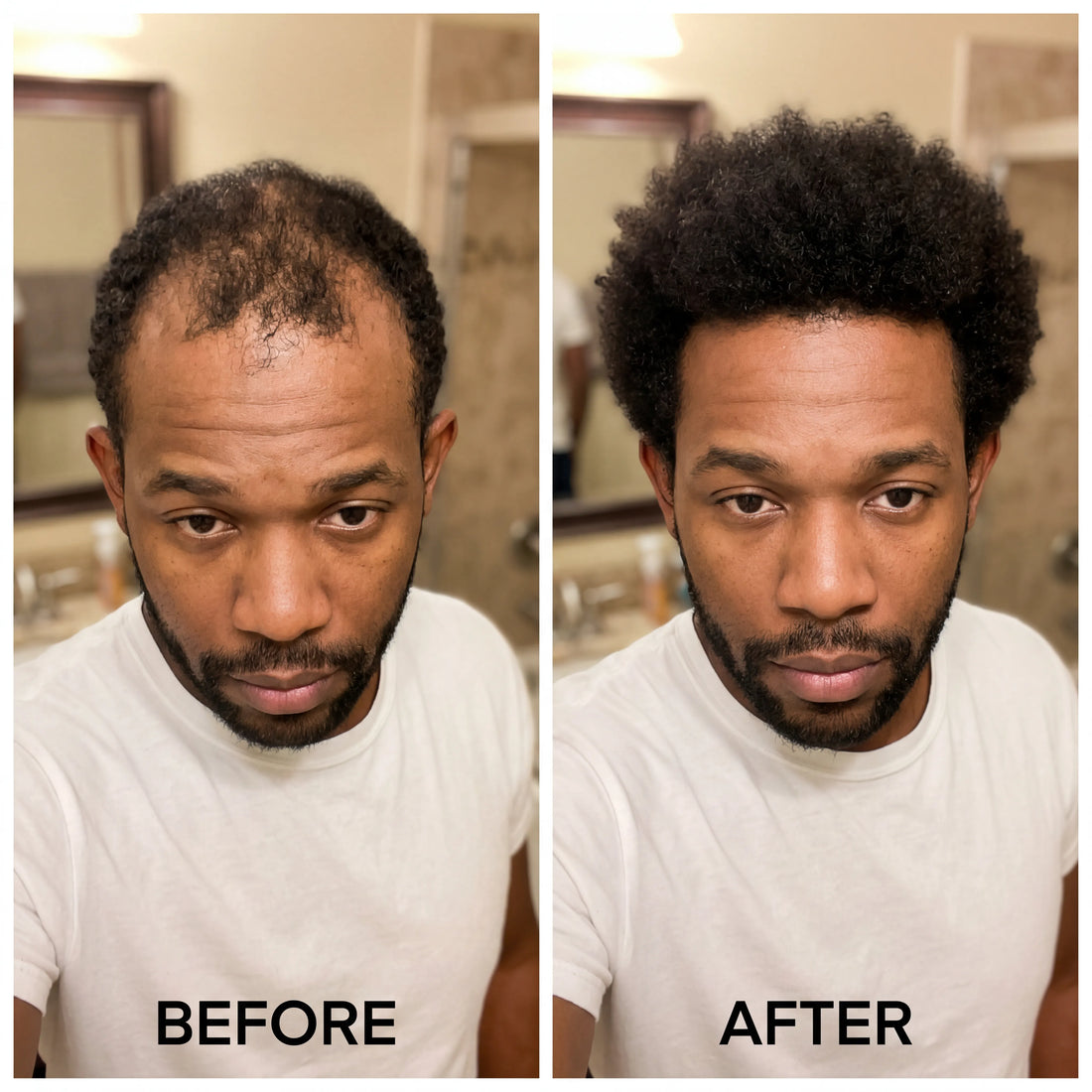 Korean Scalp Ritual Bar