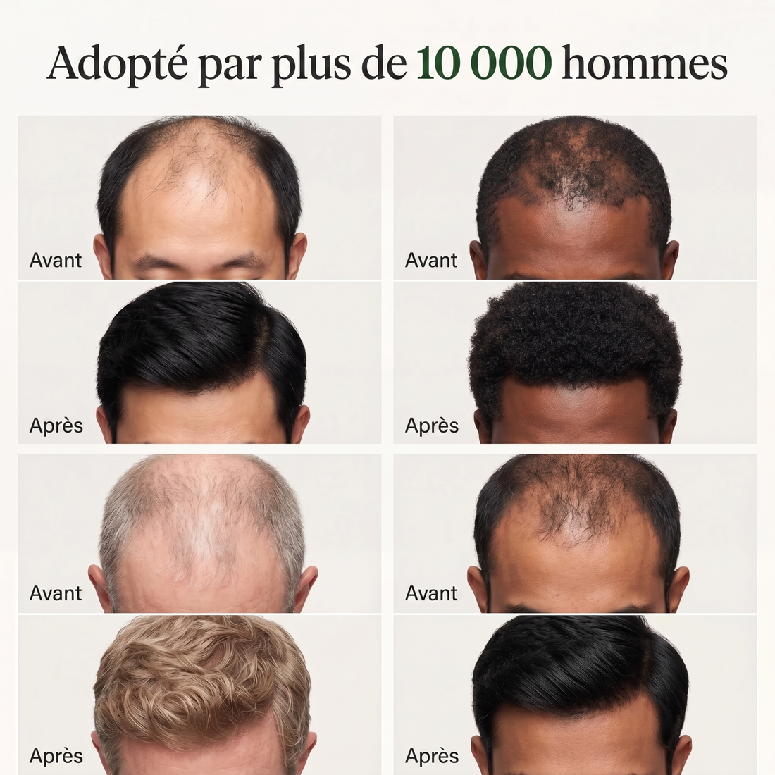 Le Rituel Capillaire Coréen des Hommes